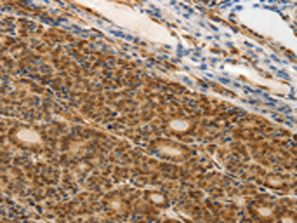 Rabbit Polyclonal Antibody to MAP1A