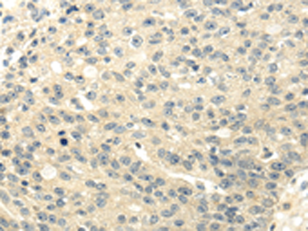 Rabbit Polyclonal Antibody to GAD1