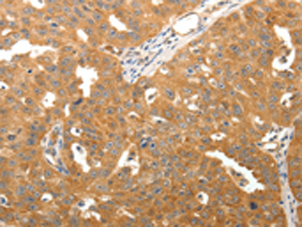 Rabbit Polyclonal Antibody to TNN