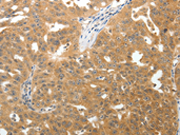 Rabbit Polyclonal Antibody to TNR