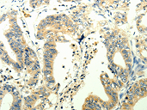 TRPM7