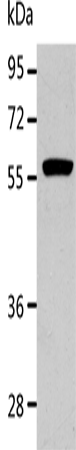 ALDH1A2