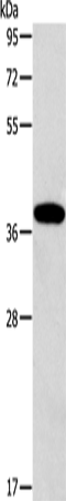 ALDOB