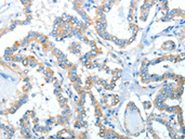 Rabbit Polyclonal Antibody to ADRA1A