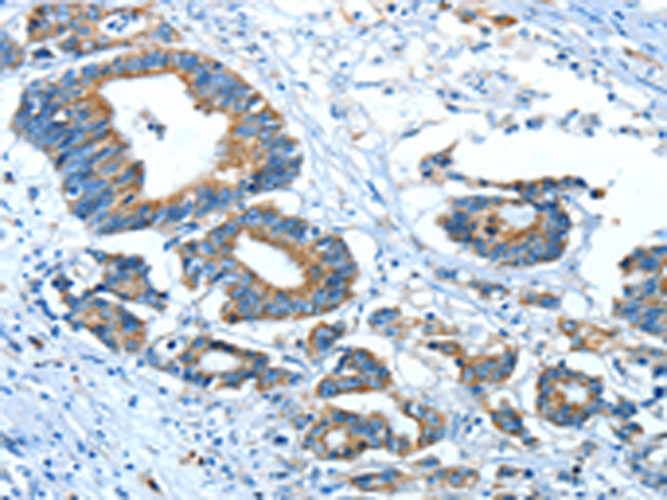 Rabbit Polyclonal Antibody to GLRA1