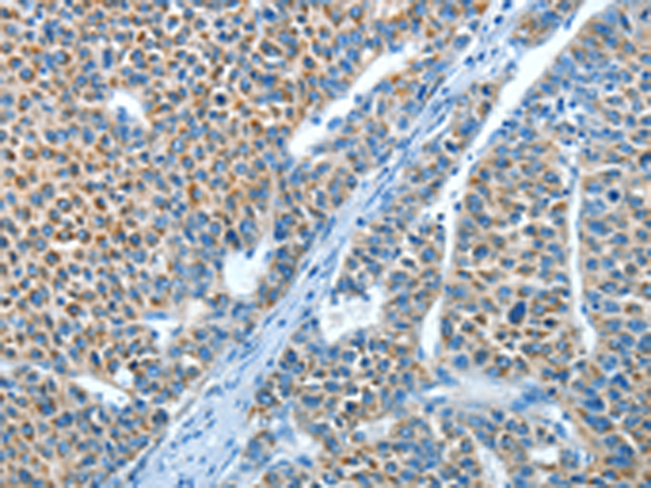 Rabbit Polyclonal Antibody to ADRA1B