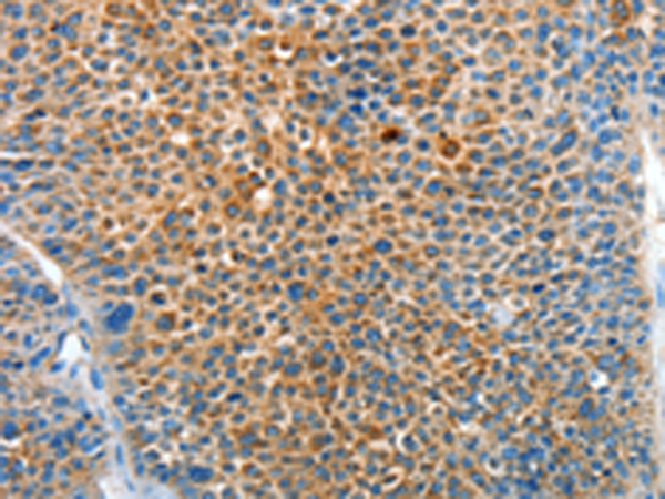 Rabbit Polyclonal Antibody to SERPINF2