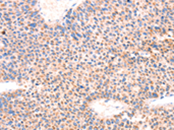 Rabbit Polyclonal Antibody to AMPD1