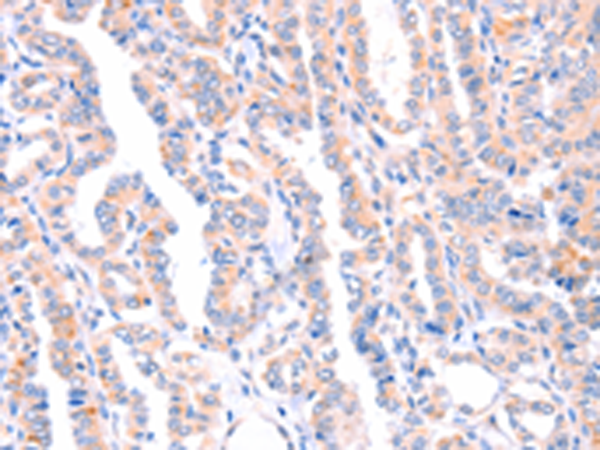 Rabbit Polyclonal Antibody to AMPD1