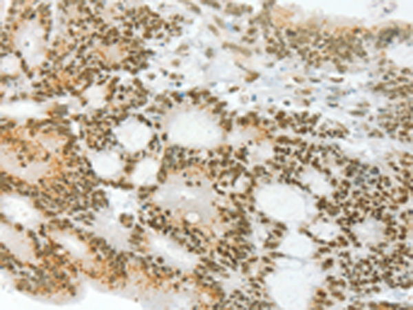 Rabbit Polyclonal Antibody to ANGPT4