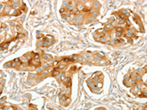 Rabbit Polyclonal Antibody to ACE