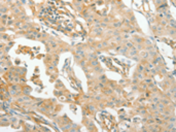 Rabbit Polyclonal Antibody to ACE