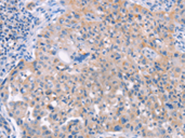 Rabbit Polyclonal Antibody to AP1B1