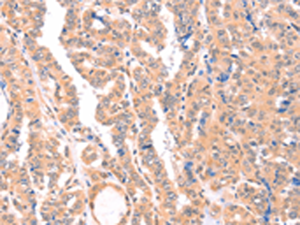 Rabbit Polyclonal Antibody to APBA2