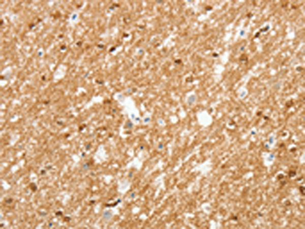 Rabbit Polyclonal Antibody to AMZ1