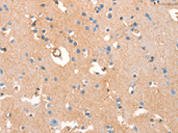Rabbit Polyclonal Antibody to ARFGEF2