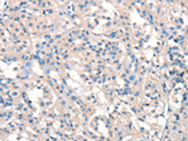 Rabbit Polyclonal Antibody to ARHGEF11