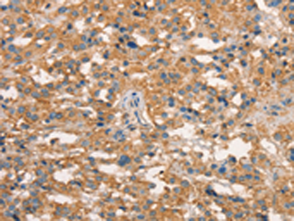Rabbit Polyclonal Antibody to ART4