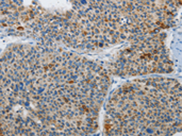 Rabbit Polyclonal Antibody to ATG4A