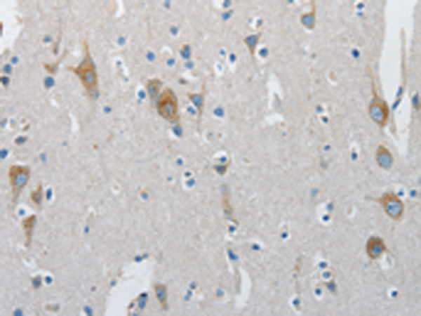 Rabbit Polyclonal Antibody to ATG4A