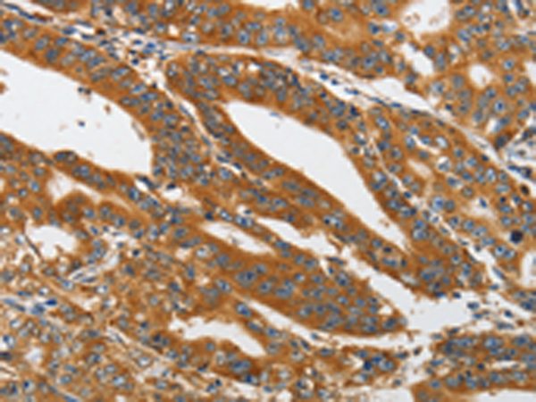 Rabbit Polyclonal Antibody to PIK3C3