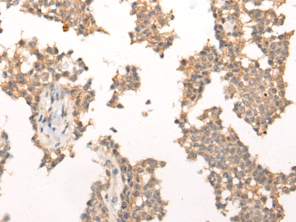 Rabbit Polyclonal Antibody to PIAS3