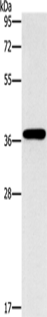 MTARC1