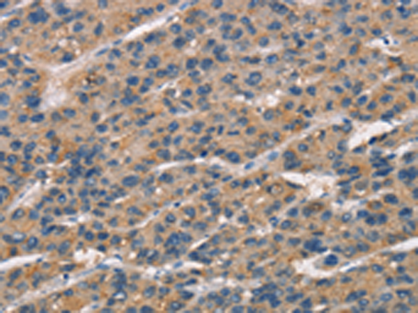 Rabbit Polyclonal Antibody to SENP1
