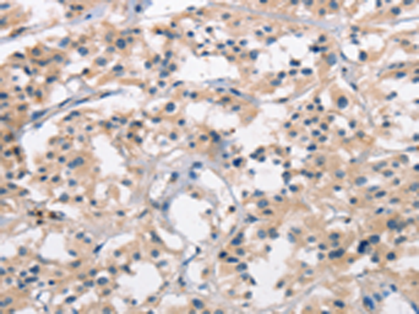 Rabbit Polyclonal Antibody to SENP1