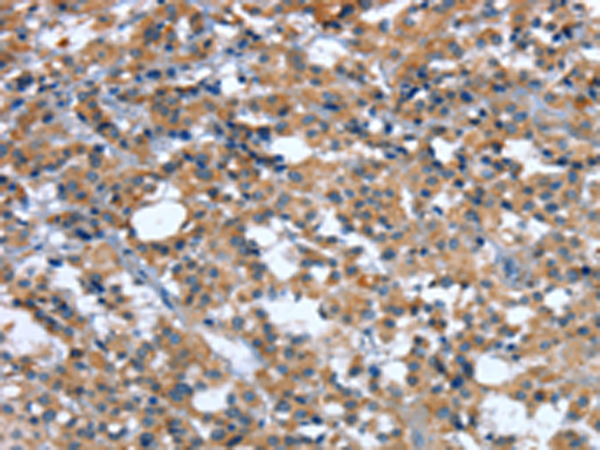 Rabbit Polyclonal Antibody to GINS1
