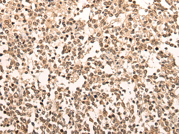 Rabbit Polyclonal Antibody to SLC29A1