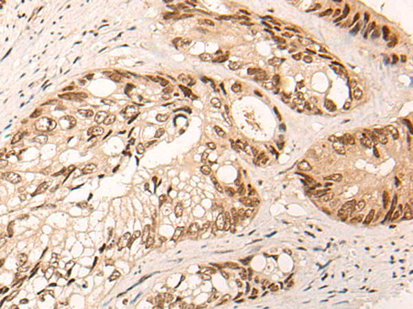 Rabbit Polyclonal Antibody to SLC29A1