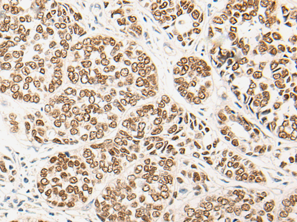 Rabbit Polyclonal Antibody to SOX9
