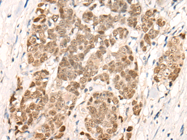 Rabbit Polyclonal Antibody to SOX9