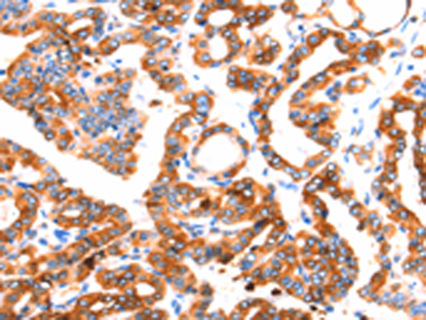 Rabbit Polyclonal Antibody to SEPTIN4