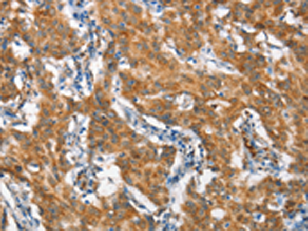Rabbit Polyclonal Antibody to STAT2