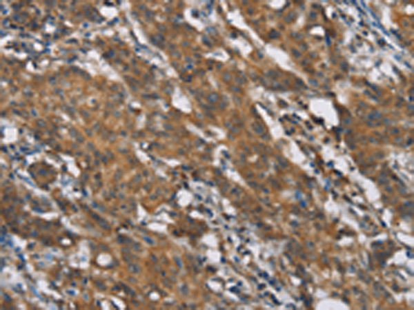 Rabbit Polyclonal Antibody to TLR6