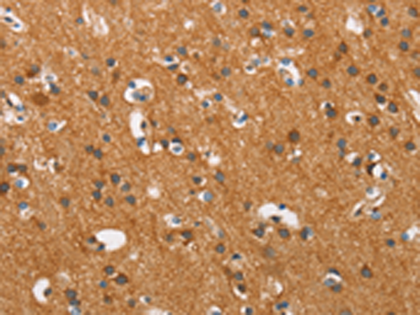 Rabbit Polyclonal Antibody to COX5A