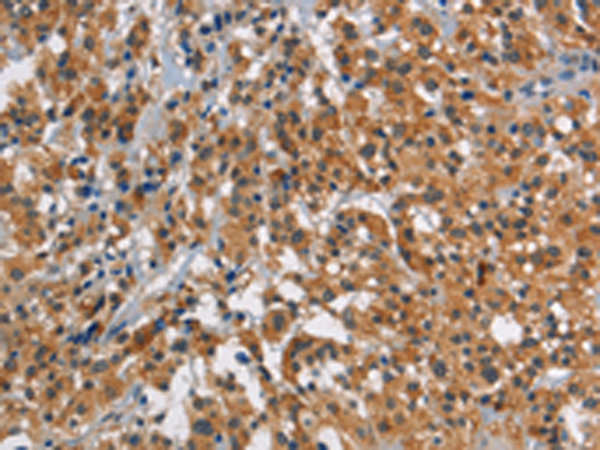 Rabbit Polyclonal Antibody to SMAD9