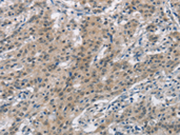Rabbit Polyclonal Antibody to SMAD9