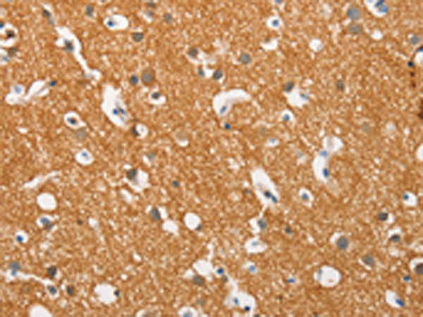 Rabbit Polyclonal Antibody to SNCA