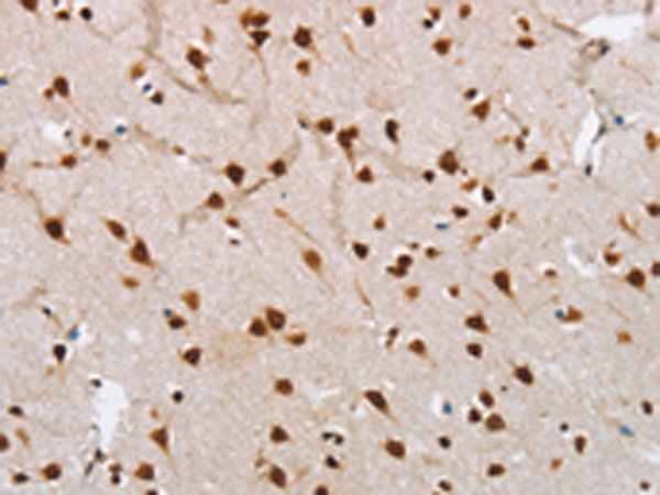 Rabbit Polyclonal Antibody to NLRP7