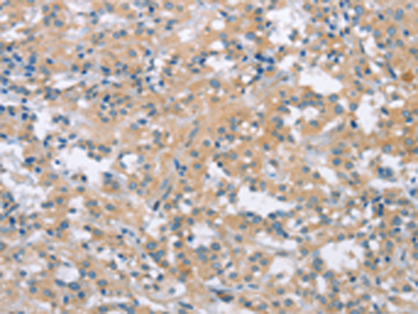 Rabbit Polyclonal Antibody to MCL1