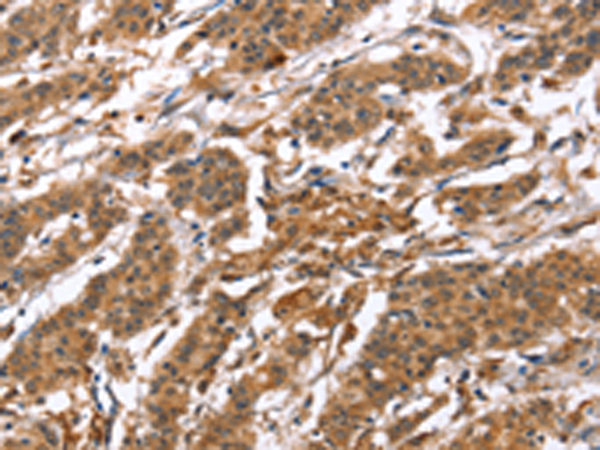 Rabbit Polyclonal Antibody to BNIP2