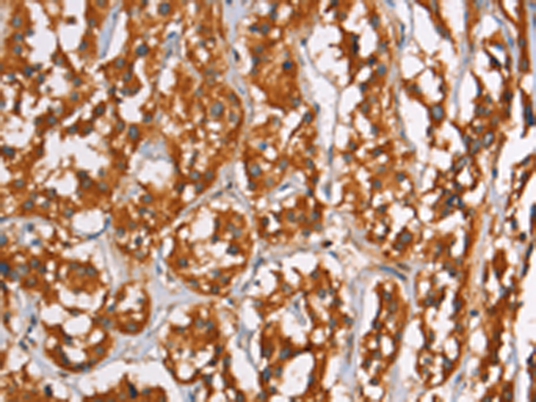 Rabbit Polyclonal Antibody to PLIN2