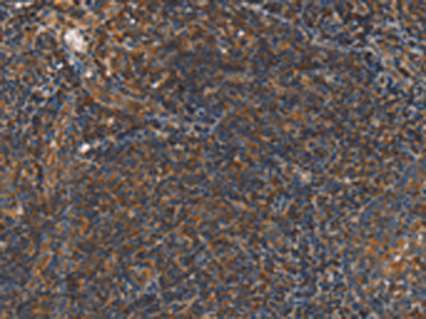 Rabbit Polyclonal Antibody to PLIN2