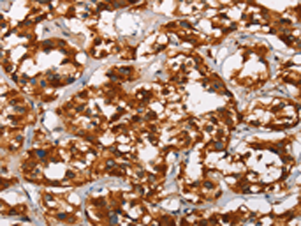 Rabbit Polyclonal Antibody to ADNP