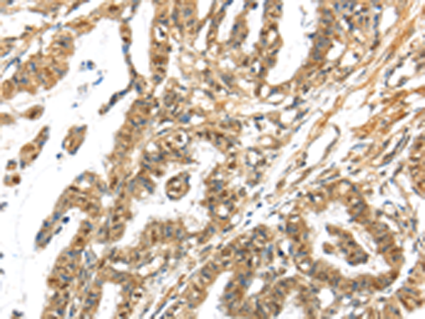 Rabbit Polyclonal Antibody to APOL6