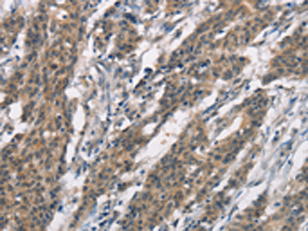 Rabbit Polyclonal Antibody to SH2B2