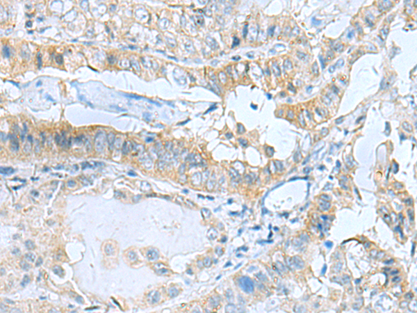 Rabbit Polyclonal Antibody to ASIC1